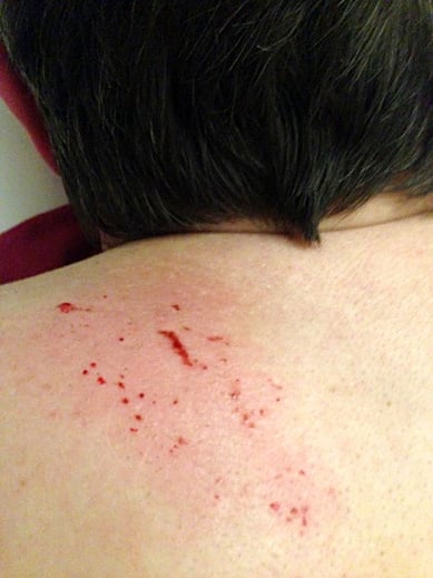 Fußreflexzonenmassagen