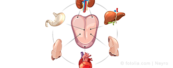 Zungendiagnose